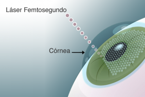 Laser de Femto-Segundo: Uma nova era